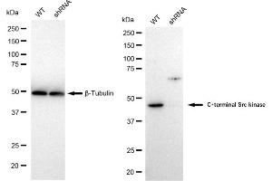 Western blotting analysis using C-terminal Src kinase antibody (ABIN7797814). (Recombinant CSK antibody)