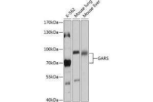 Western blot analysis of extracts of various cell lines, using GARS antibody (ABIN6127941, ABIN6140963, ABIN6140965 and ABIN6217253) at 1:1000 dilution. (GARS antibody  (AA 60-370))