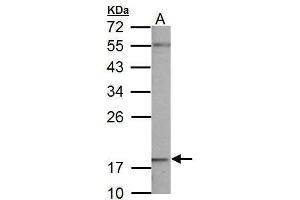 WB Image NDUFB5 antibody detects NDUFB5 protein by Western blot analysis.
