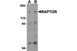 Western Blotting (WB) image for anti-RAPTOR (RAPTOR) (Middle Region) antibody (ABIN1031053) (RAPTOR antibody  (Middle Region))