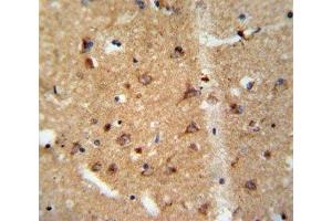 IHC analysis of FFPE human brain tissue stained with GDNF antibody (GDNF antibody  (AA 8-36))