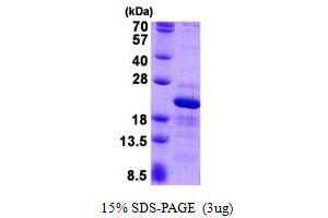 Image no. 1 for Ribosomal Protein S10 (RPS10) protein (His tag) (ABIN1098579) (RPS10 Protein (His tag))