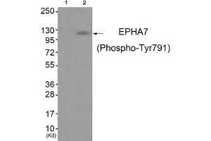 Western blot analysis of extracts from JK cells (Lane 2), using EPHA7 (Phospho-Tyr791) Antibody. (EPH Receptor A7 antibody  (pTyr791))