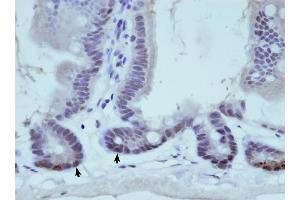 THOC1 antibody was used for immunohistochemistry at a concentration of 0. (THOC1 antibody  (C-Term))