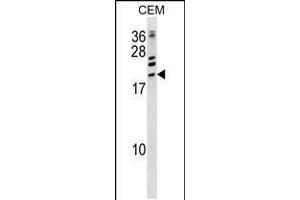 Western blot analysis in CEM cell line lysates (35ug/lane). (ATF3 antibody  (C-Term))