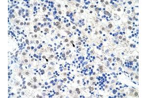 DDX47 antibody was used for immunohistochemistry at a concentration of 4-8 ug/ml to stain Hepatocytes (arrows) in Human Liver. (DDX47 antibody)