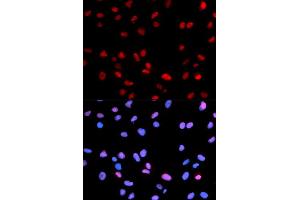 Immunofluorescence (IF) image for anti-Retinoblastoma 1 (RB1) (pSer795) antibody (ABIN1870564) (Retinoblastoma 1 antibody  (pSer795))