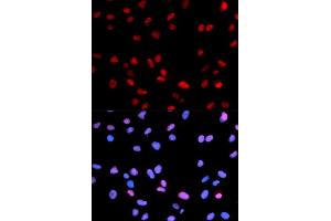 Immunofluorescence (IF) image for anti-Retinoblastoma 1 (RB1) (pSer795) antibody (ABIN1870564) (Retinoblastoma 1 antibody  (pSer795))