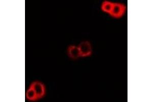 Immunofluorescent analysis of DNAJA3 staining in U2OS cells. (DNAJA3 antibody)