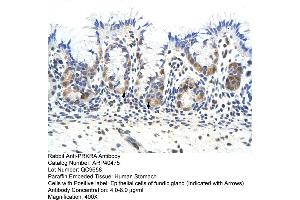 Rabbit Anti-PRKRA Antibody  Paraffin Embedded Tissue: Human Stomach Cellular Data: Epithelial cells of fundic gland Antibody Concentration: 4. (PRKRA antibody  (Middle Region))