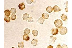 Immunohistochemistry (IHC) image for anti-Metastasis Associated 1 Family, Member 2 (MTA2) antibody (ABIN1031775) (MTA2 antibody)