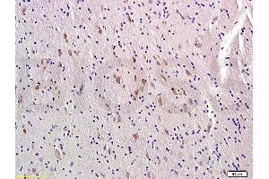 Formalin-fixed and paraffin-embedded rat brain labeled with Rabbit Anti-MTNR1A/MTR-1A/MEL-1A-R Polyclonal Antibody, Unconjugated (ABIN723815) at 1:300 followed by conjugation to the secondary antibody (Melatonin Receptor 1A antibody  (AA 201-280))