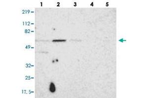Western blot analysis of Lane 1: RT-4, Lane 2: U-251 MG, Lane 3: A-431, Lane 4: Liver, Lane 5: Tonsil with UPF3B polyclonal antibody  at 1:250-1:500 dilution. (UPF3B antibody)