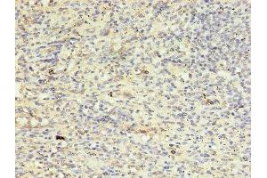 Immunohistochemistry of paraffin-embedded human spleen tissue using ABIN7145079 at dilution of 1:100 (Aurora Kinase B antibody  (AA 1-255))