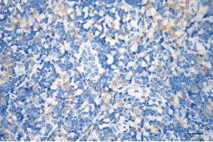 anti-N-Acetylglucosamine Kinase (NAGK) antibody