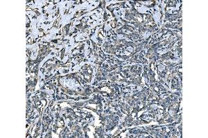 IHC analysis of SPG3A/ATL1 using anti-SPG3A/ATL1 antibody (ABIN7603095). (ATL1 antibody  (Middle Region))