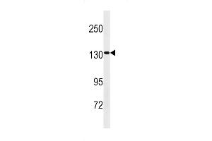 SS2 Antibody (Center) 20308c western blot analysis in HepG2 cell line lysates (35 μg/lane). (SAPS2 antibody  (AA 565-593))