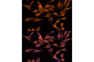 Immunofluorescence analysis of HeLa cells using UNG antibody (ABIN6135163, ABIN6149935, ABIN6149937 and ABIN6217044) at dilution of 1:100. (UNG antibody  (AA 1-100))