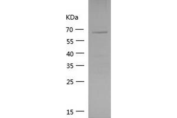 Vinculin Protein (VCL) (AA 777-1066) (GST tag)