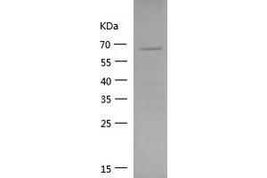 Western Blotting (WB) image for Vinculin (VCL) (AA 777-1066) protein (GST tag) (ABIN7125717) (Vinculin Protein (VCL) (AA 777-1066) (GST tag))