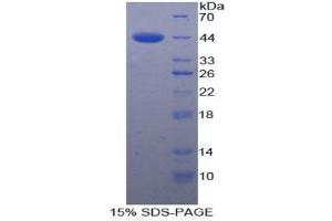 SDS-PAGE (SDS) image for Complement Factor H (CFH) (AA 860-1231) protein (His tag) (ABIN1079269)