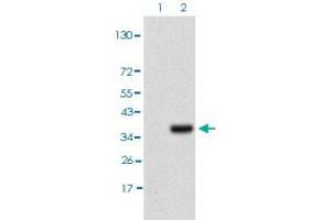Western blot analysis of Lane 1: HEK293T cell lysate, Lane 2: IL3RA (a. (IL3RA antibody)
