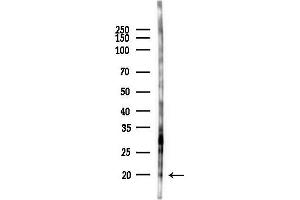 Western blot analysis of lysates from HUVEC cells(starvation 24h treatment), using LY6G6D Antibody at 1/1000 dilution.