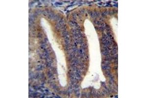 Formalin fixed, paraffin embedded human uterus tissue stained with RBPMS2 Antibody  followed by peroxidase conjugation of the secondary antibody and DAB staining. (RBPMS2 antibody  (Middle Region))