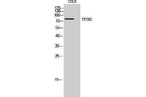 Western Blotting (WB) image for anti-Tripartite Motif Containing 3 (TRIM3) (N-Term) antibody (ABIN3187338)