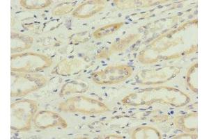 Immunohistochemistry of paraffin-embedded human kidney tissue using ABIN7170943 at dilution of 1:100 (Sulfide:quinone Oxidoreductase, Mitochondrial (SQOR) (AA 211-450) antibody)