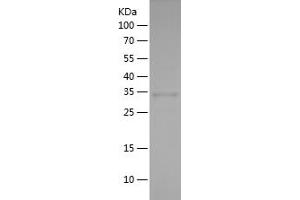 IRF7 Protein (AA 67-287) (His tag)