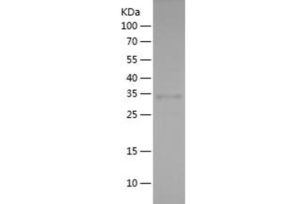 IRF7 Protein (AA 67-287) (His tag)