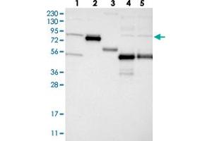 Western blot analysis of Lane 1: RT-4, Lane 2: U-251 MG, Lane 3: Human Plasma, Lane 4: Liver, Lane 5: Tonsil with GLT25D2 polyclonal antibody  at 1:250-1:500 dilution.