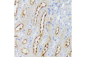 Immunohistochemistry of paraffin-embedded mouse kidney using Nectin 2/CD112 Rabbit mAb (ABIN7269432) at dilution of 1:100 (40x lens). (PVRL2 antibody)
