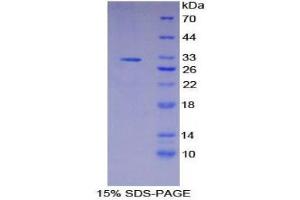 SDS-PAGE (SDS) image for Pigeon Homolog (PION) (AA 616-854) protein (His tag) (ABIN1877517)