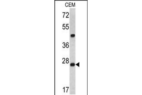 Endoribonuclease Dcr-1 (Dcr-1) (AA 1068-1097) Antikörper
