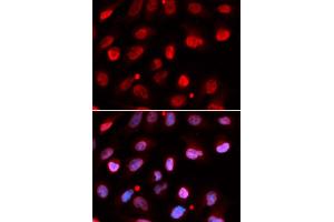 Immunofluorescence (IF) image for anti-Ring Finger Protein 2 (RNF2) antibody (ABIN1876743) (RNF2 antibody)