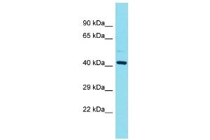 Western Blotting (WB) image for anti-Family with Sequence Similarity 181, Member B (FAM181B) (N-Term) antibody (ABIN2791533) (FAM181B antibody  (N-Term))