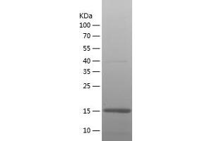 GFAP Protein (AA 292-432) (His tag)