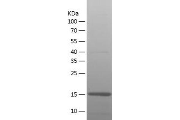 GFAP Protein (AA 292-432) (His tag)