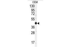 Image no. 1 for anti-Gap Junction Protein, alpha 1, 43kDa (GJA1) (N-Term) antibody (ABIN357085)