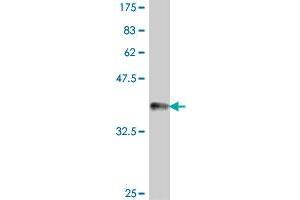 Western Blot detection against Immunogen (37. (PNKP antibody  (AA 422-521))