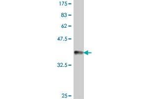 PNKP antibody  (AA 422-521)