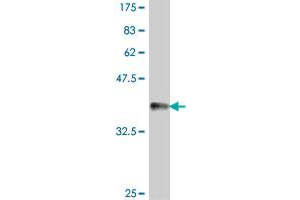 PNKP antibody  (AA 422-521)