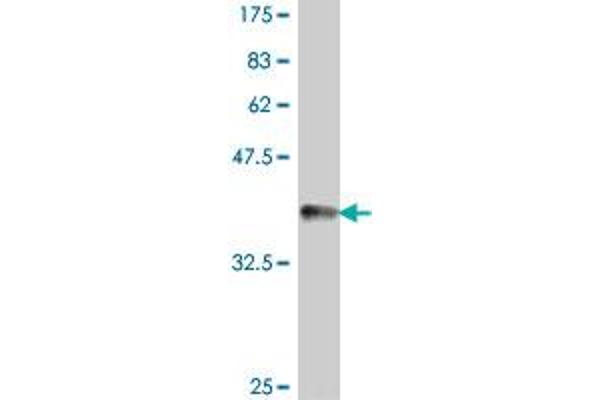 PNKP antibody  (AA 422-521)