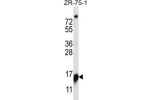 Western Blotting (WB) image for anti-Ribonuclease P/MRP 25kDa Subunit (RPP25) antibody (ABIN2997146) (RPP25 antibody)