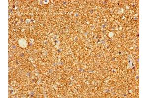 Immunohistochemistry of paraffin-embedded human brain tissue using ABIN7153961 at dilution of 1:100 (Glutamate Receptor 3 antibody  (AA 151-250))