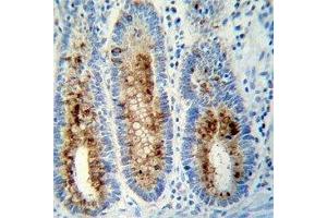 Anti-Myeloperoxidase antibody immunohistochemistry analysis in formalin fixed and paraffin embedded human colon tissue. (Myeloperoxidase antibody  (AA 420-448))