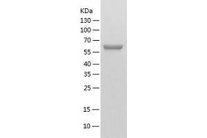 Western Blotting (WB) image for Valosin Containing Protein (VCP) (AA 1-589) protein (His tag) (ABIN7286498) (VCP Protein (AA 1-589) (His tag))