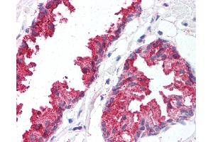 Anti-BACE1 antibody IHC of human prostate. (BACE1 antibody  (C-Term))